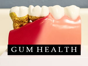 Gum Health